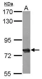 Anti-HSC70 antibody used in Western Blot (WB). GTX101144