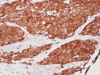 Anti-HSP27 antibody used in IHC (Paraffin sections) (IHC-P). GTX101145