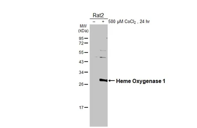 Anti-Heme Oxygenase 1 antibody used in Western Blot (WB). GTX101147