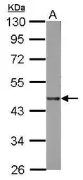 Anti-LAL antibody [N3C3] used in Western Blot (WB). GTX101169