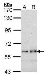 Anti-FYN antibody [N1N3] used in Western Blot (WB). GTX101189