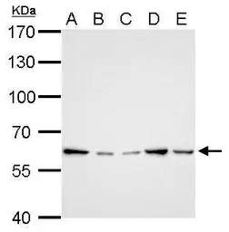 Anti-GGT1 antibody used in Western Blot (WB). GTX101198