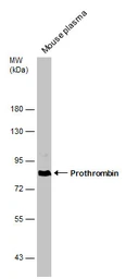 Anti-Prothrombin antibody used in Western Blot (WB). GTX101199