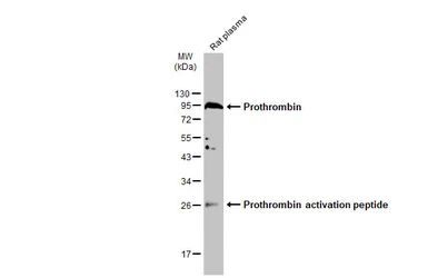 Anti-Prothrombin antibody used in Western Blot (WB). GTX101199