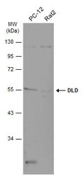 Anti-DLD antibody [N1N3] used in Western Blot (WB). GTX101232