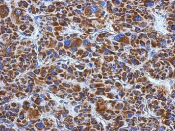 Anti-DLD antibody [N1N3] used in IHC (Paraffin sections) (IHC-P). GTX101232