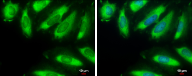 Anti-eIF2 alpha antibody [N1C3] used in Immunocytochemistry/ Immunofluorescence (ICC/IF). GTX101241
