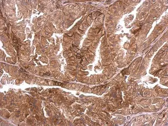 Anti-DMPK antibody used in IHC (Paraffin sections) (IHC-P). GTX101248