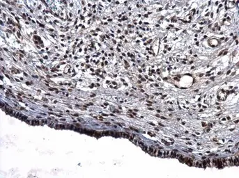 Anti-CBP antibody [C3], C-term used in IHC (Paraffin sections) (IHC-P). GTX101249