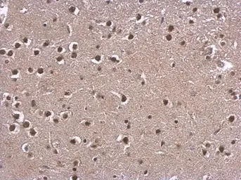 Anti-CBP antibody [C3], C-term used in IHC (Paraffin sections) (IHC-P). GTX101249