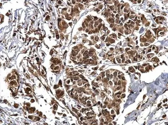 Anti-CBP antibody [C3], C-term used in IHC (Paraffin sections) (IHC-P). GTX101249