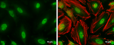 Anti-CBP antibody [C3], C-term used in Immunocytochemistry/ Immunofluorescence (ICC/IF). GTX101249