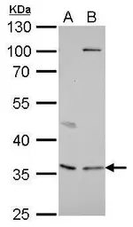 Anti-Decorin antibody used in Western Blot (WB). GTX101250