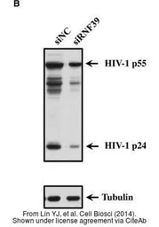 Anti-beta Tubulin antibody used in Western Blot (WB). GTX101279