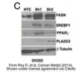 Anti-beta Tubulin antibody used in Western Blot (WB). GTX101279