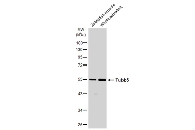 Anti-beta Tubulin antibody used in Western Blot (WB). GTX101279