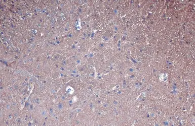 Anti-beta Tubulin antibody used in IHC (Paraffin sections) (IHC-P). GTX101279