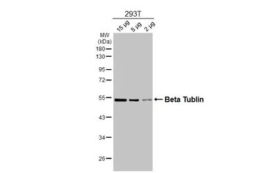 Anti-beta Tubulin antibody used in Western Blot (WB). GTX101279