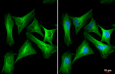 Anti-beta Tubulin antibody used in Immunocytochemistry/ Immunofluorescence (ICC/IF). GTX101279