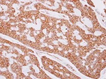 Anti-beta Tubulin antibody used in IHC (Paraffin sections) (IHC-P). GTX101279