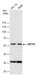 Anti-MEF2A antibody [C2C3], C-term used in Western Blot (WB). GTX101286