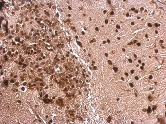 Anti-MEF2A antibody [C2C3], C-term used in IHC (Paraffin sections) (IHC-P). GTX101286