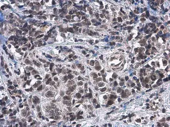 Anti-ATRX antibody [C3], C-term used in IHC (Paraffin sections) (IHC-P). GTX101310