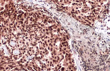 Anti-ATRX antibody [C3], C-term used in IHC (Paraffin sections) (IHC-P). GTX101310