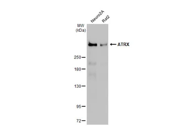 Anti-ATRX antibody [C3], C-term used in Western Blot (WB). GTX101310