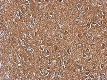 Anti-AXL antibody [C2C3], C-term used in IHC (Paraffin sections) (IHC-P). GTX101345