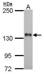 Anti-AXL antibody [C2C3], C-term used in Western Blot (WB). GTX101345