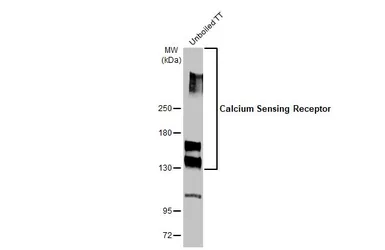 Anti-Calcium Sensing Receptor antibody used in Western Blot (WB). GTX101348