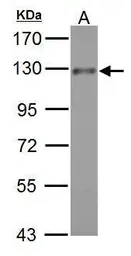 Anti-ADAM17 antibody [C2C3], C-term used in Western Blot (WB). GTX101358