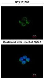 Anti-ACADM antibody used in Immunocytochemistry/ Immunofluorescence (ICC/IF). GTX101393