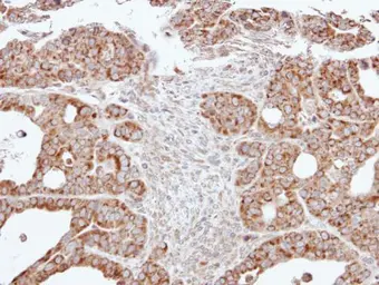 Anti-ACADM antibody used in IHC (Paraffin sections) (IHC-P). GTX101393