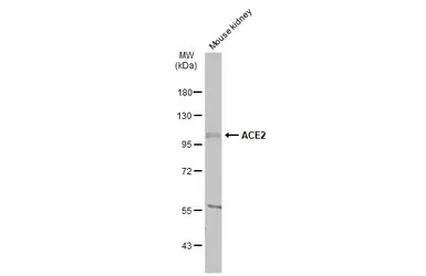 Anti-ACE2 antibody [N1N2], N-term used in Western Blot (WB). GTX101395