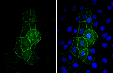 Anti-ACE2 antibody [N1N2], N-term used in Immunocytochemistry/ Immunofluorescence (ICC/IF). GTX101395