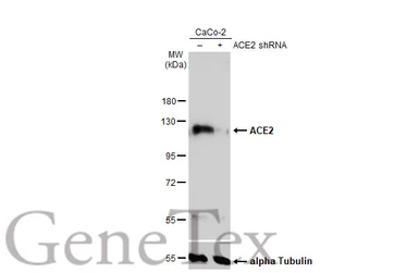 Anti-ACE2 antibody [N1N2], N-term used in Western Blot (WB). GTX101395