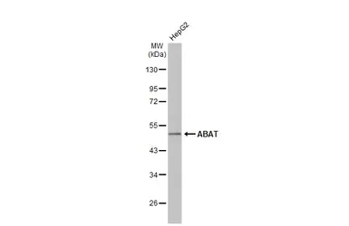 Anti-ABAT antibody used in Western Blot (WB). GTX101413