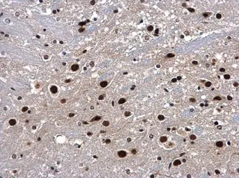 Anti-p54nrb antibody used in IHC (Paraffin sections) (IHC-P). GTX101419