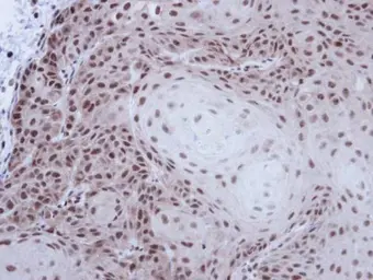 Anti-p54nrb antibody used in IHC (Paraffin sections) (IHC-P). GTX101419