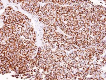 Anti-ALDH2 antibody used in IHC (Paraffin sections) (IHC-P). GTX101429