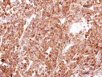 Anti-PDI antibody [N1N3] used in IHC (Paraffin sections) (IHC-P). GTX101468