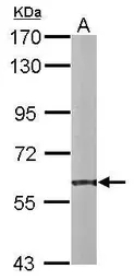 Anti-PDI antibody [N1N3] used in Western Blot (WB). GTX101468