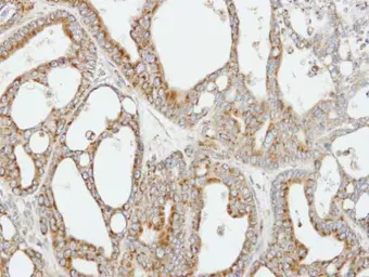Anti-COX5B antibody [N1C3] used in IHC (Paraffin sections) (IHC-P). GTX101486