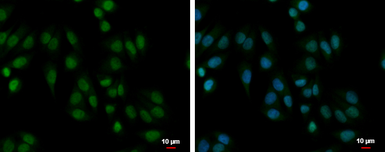 Anti-PABPN1 antibody used in Immunocytochemistry/ Immunofluorescence (ICC/IF). GTX101490