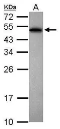 Anti-PABPN1 antibody used in Western Blot (WB). GTX101490