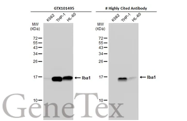 Anti-Iba1 antibody used in Western Blot (WB). GTX101495