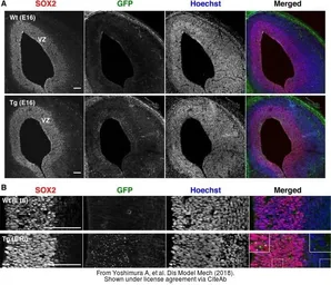 Anti-SOX2 antibody [N1C3] used in IHC (Frozen sections) (IHC-Fr). GTX101507