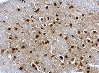 Anti-SOX2 antibody [N1C3] used in IHC (Paraffin sections) (IHC-P). GTX101507